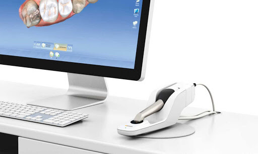 cerec-timberhill-dental